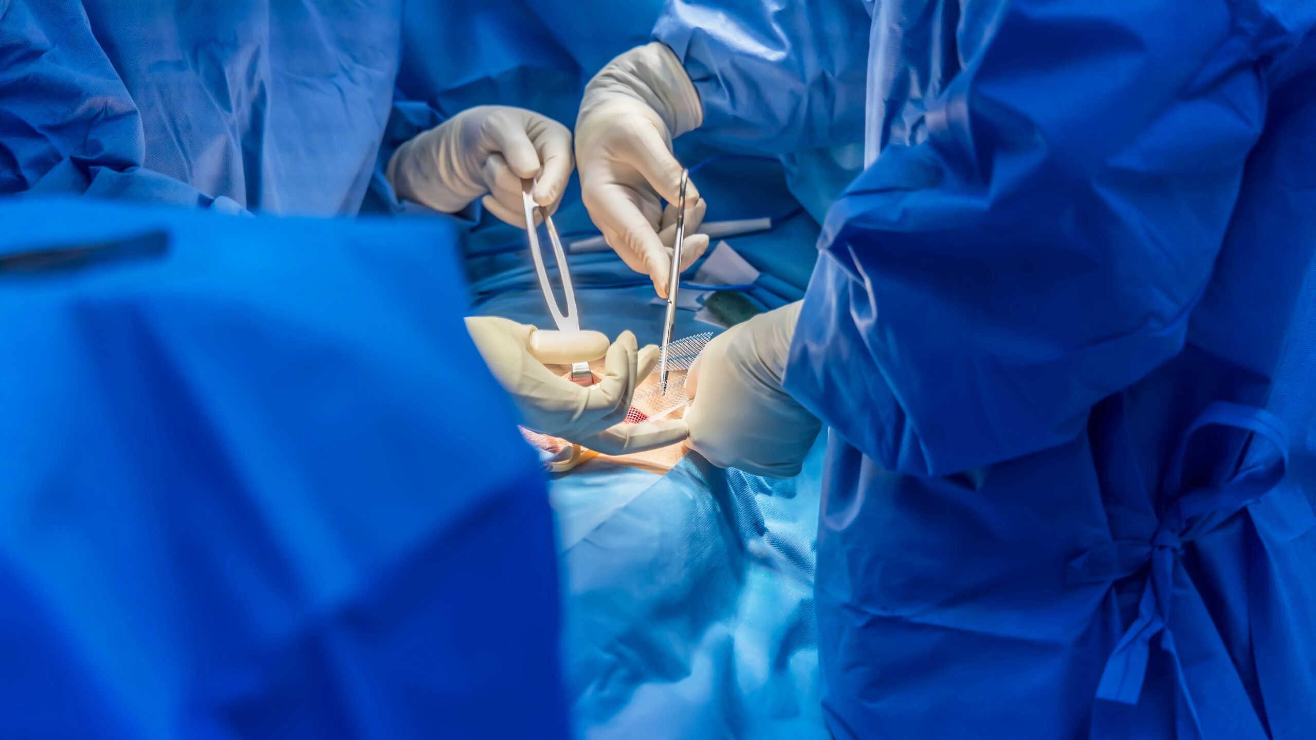 Hospital surgery with blue gowns and surgical tools